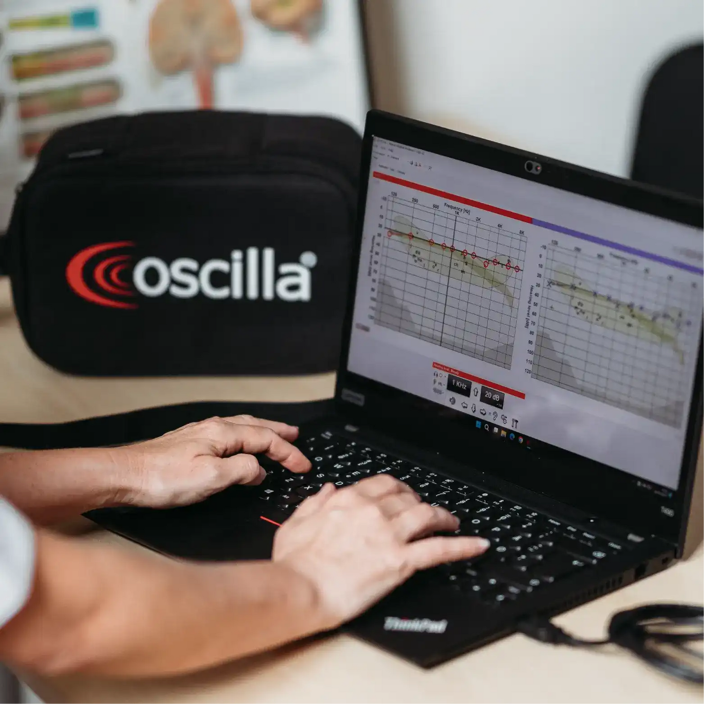 Oscilla A60